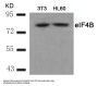 Anti-eIF4B(Ab-422) Antibody