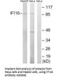 Anti-IFI16 Antibody
