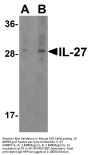 Anti-IL-27 Antibody