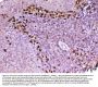 Anti-ADA Antibody Picoband®