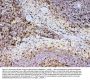 Anti-ADA Antibody Picoband®
