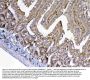 Anti-ADA Antibody Picoband®