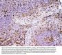 Anti-ADA Antibody Picoband®