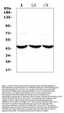 Anti-ADA Antibody Picoband®