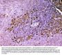 Anti-ADA Antibody Picoband®