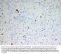 Anti-ADA Antibody Picoband®