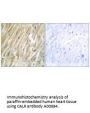Anti-CALR/Calreticulin Antibody
