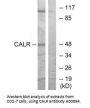 Anti-CALR/Calreticulin Antibody