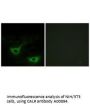 Anti-CALR/Calreticulin Antibody