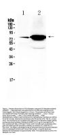 Anti-FSH Receptor/FSHR Antibody PicobandÂ®