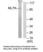 Anti-MLTK MAP3K20 Antibody