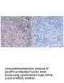 Anti-Cytochrome c-type Heme Lyase HCCS Antibody
