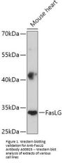 Anti-FasLG Antibody