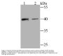 Anti-Bone marrow stromal antigen 2 BST2 Antibody