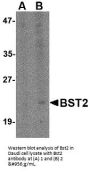 Anti-Bone marrow stromal antigen 2 Bst2 Antibody
