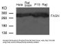Anti-Fatty Acid Synthase(FASN) Antibody
