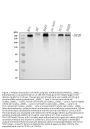 Anti-Mannose 6 Phosphate Receptor (Cation independent)/IGF2R Antibody Picoband®