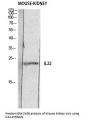 Anti-IL-22 Antibody