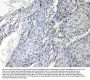 Anti-Nucleoside phosphorylase/PNP Antibody Picoband®