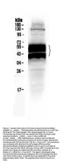 Anti-uPA Receptor/PLAUR Antibody Picoband®