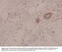 Anti-AMPK Alpha 1/2 (phospho-T183/172) PRKAA1 Antibody