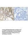 Anti-LATS1/2 Antibody