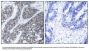 Anti-Pyk2(Ab-402) PTK2B Antibody