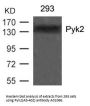 Anti-Pyk2(Ab-402) PTK2B Antibody
