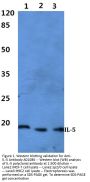 Anti-IL-5 Antibody