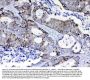 Anti-PI3 Kinase p110 beta/PIK3CB Antibody Picoband®