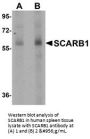 Anti-SCARB1 Antibody