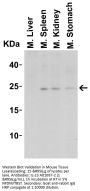 Anti-IL-23 Antibody