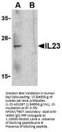 Anti-IL-23 Antibody