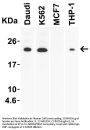 Anti-IL-23 Antibody