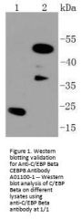 Anti-C/EBP Beta CEBPB Antibody
