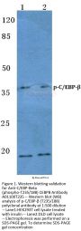 Anti-C/EBP-Beta (phospho-T235/188) CEBPB Antibody