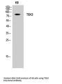 Anti-TBX3 Antibody