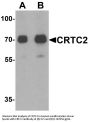 Anti-CRTC2 Antibody