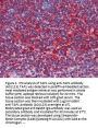 Anti-Antigen peptide transporter 1 TAP1 Antibody
