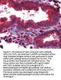 Anti-Antigen peptide transporter 1 TAP1 Antibody