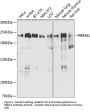Anti-Protein polybromo-1 PBRM1 Antibody