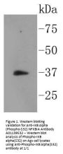 Anti-IKB Alpha (Phospho-S32) NFKBIA Antibody