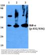 Anti-IkB-Alpha (phospho-S32/S36) NFKBIA Antibody