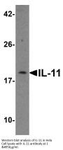 Anti-IL-11 Antibody