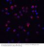 Anti-IL-11 Antibody
