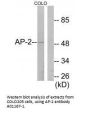 Anti-AP-2 TFAP2A Antibody