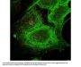 Anti-Gli-3 Antibody