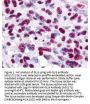 Anti-Gli-3 Antibody