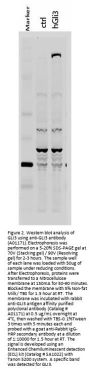 Anti-Gli-3 Antibody