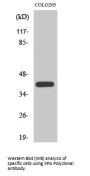 Anti-XPA Antibody